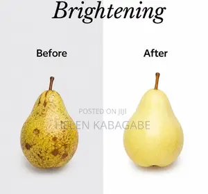 Arbutin Depigmentation Face and Body Lotion