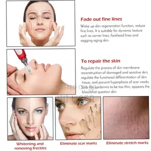 Derma Pen (Microneedling)