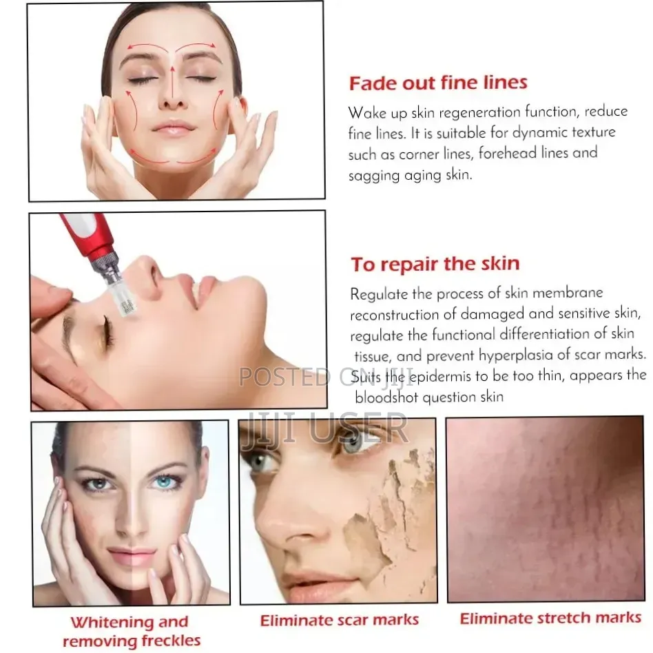 Derma Pen (Microneedling)