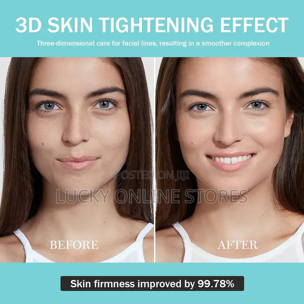 Anti Aging Facial Treatment Device