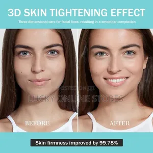 Anti Aging Facial Treatment Device