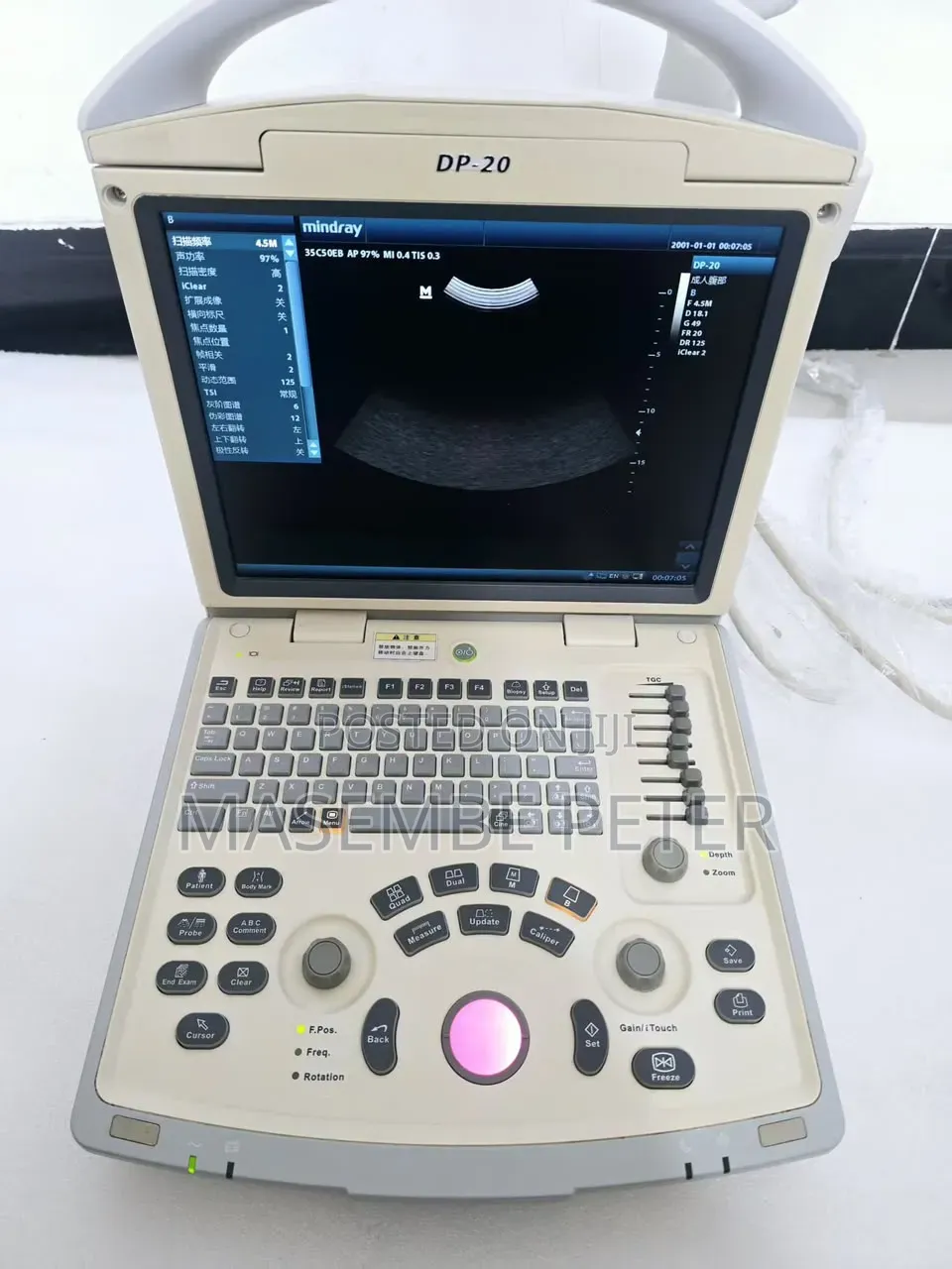 Mindray Dp 20
