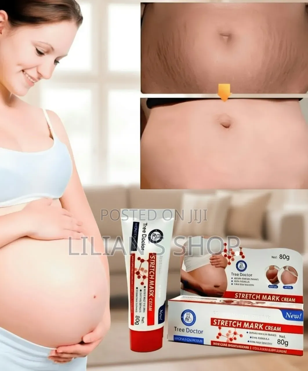 Tree Doctor Stretch Mark Cream