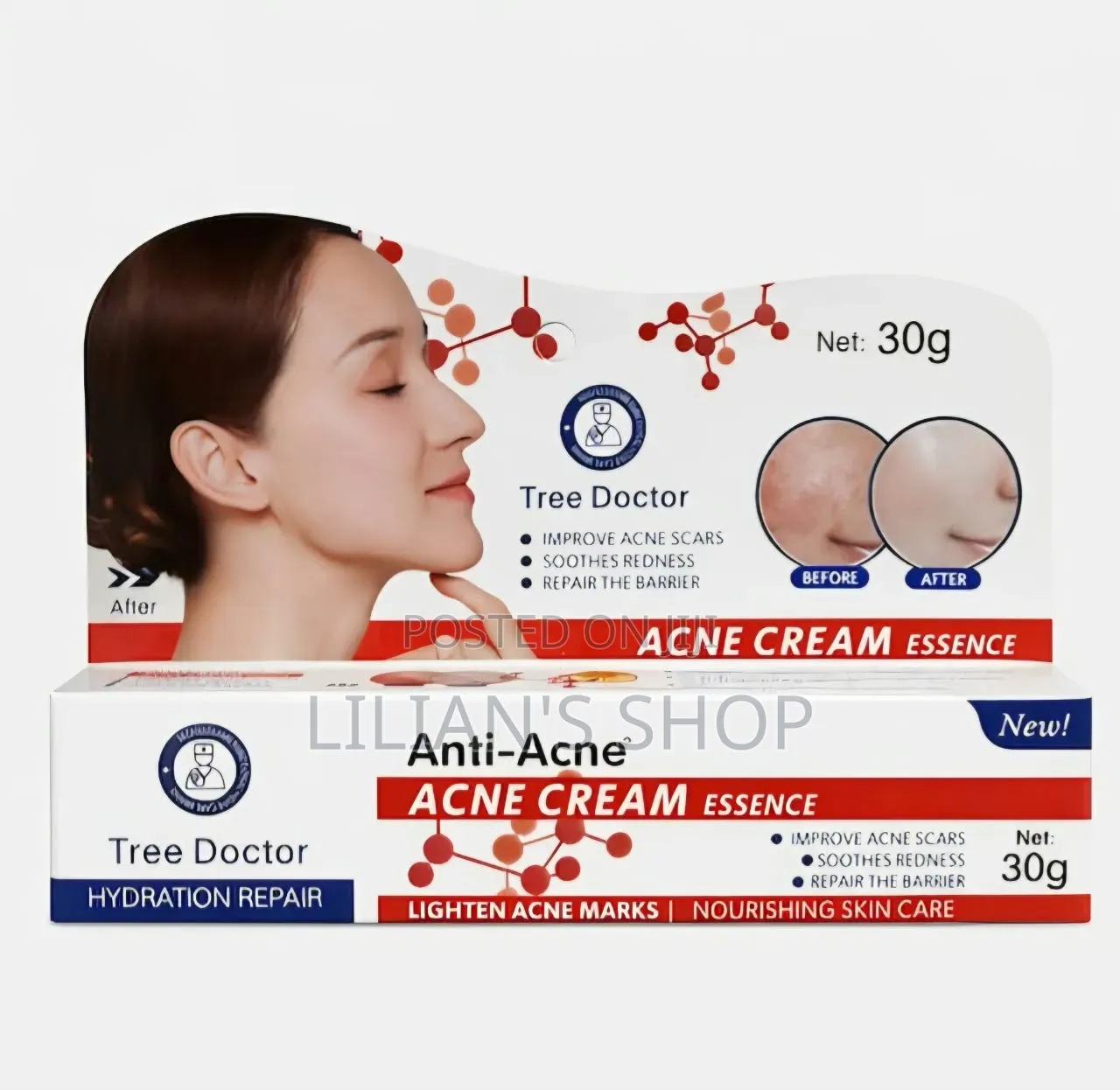 Tree Doctor Anti-Acne Cream Face 30ml