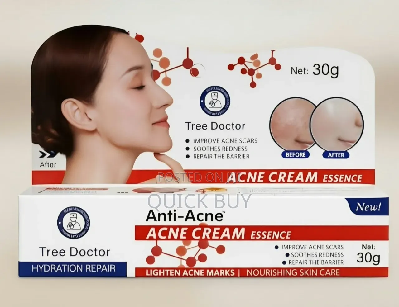 Tree Doctor Anti-Acne Cream Face 30ml