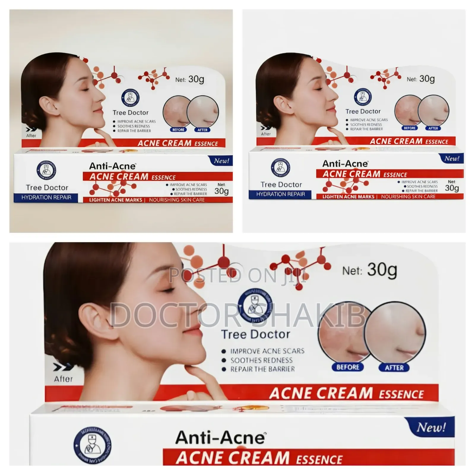 Tree Doctor Anti-Acne Cream Face 30ml