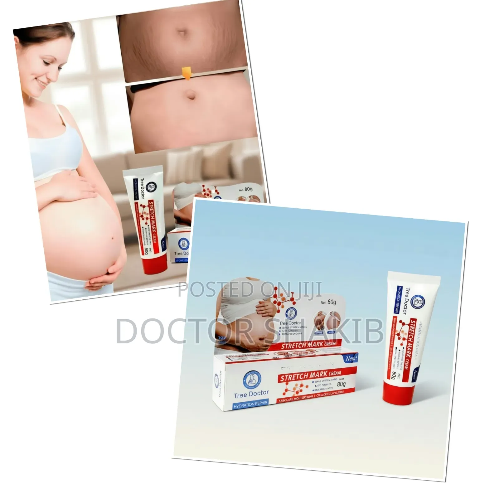 Tree Doctor Stretch Mark Cream