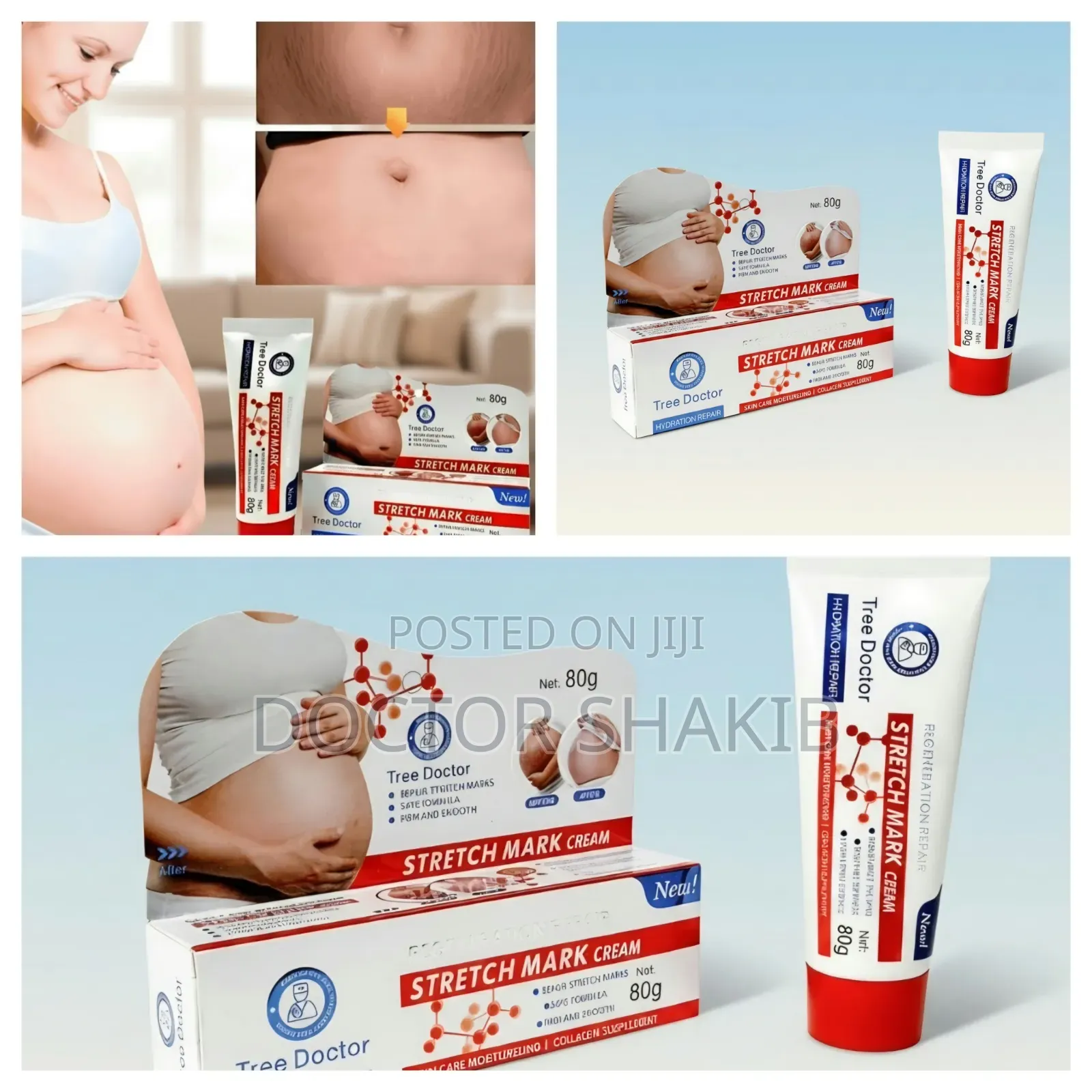 Tree Doctor Stretch Mark Cream