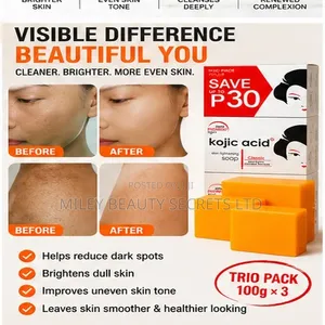 Kojic Acid Skin Brightening Soap — Trio Pack