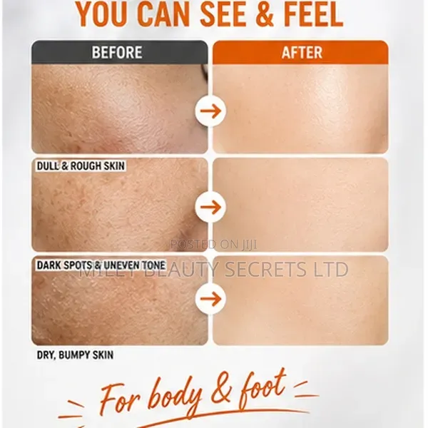 Dr. Melaxin Peel Shot Ps — Exfoliating Kojic Acid + Turmeric Spray