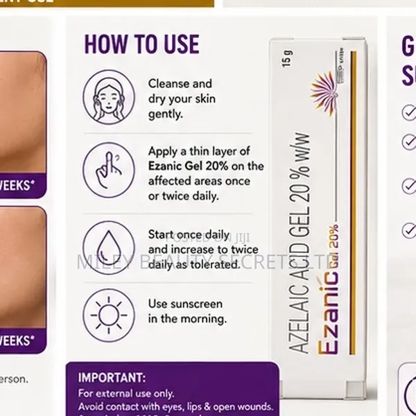 Ezanic Gel 20% — Azelaic Acid 20%