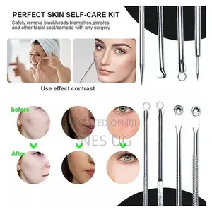 4Pcs Set Blackhead Removal Tool Kit
