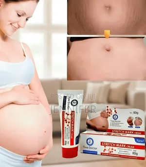 Tree Doctor Stretch Mark Cream