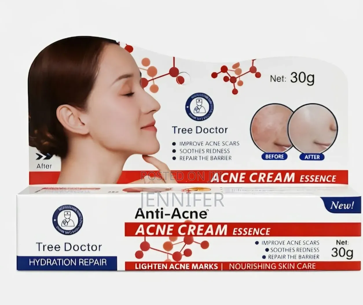 Tree Doctor Anti-Acne Cream Face 30ml