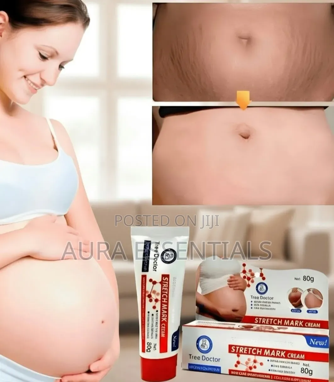Tree Doctor Stretch Mark Cream