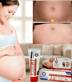 Tree Doctor Stretch Mark Cream