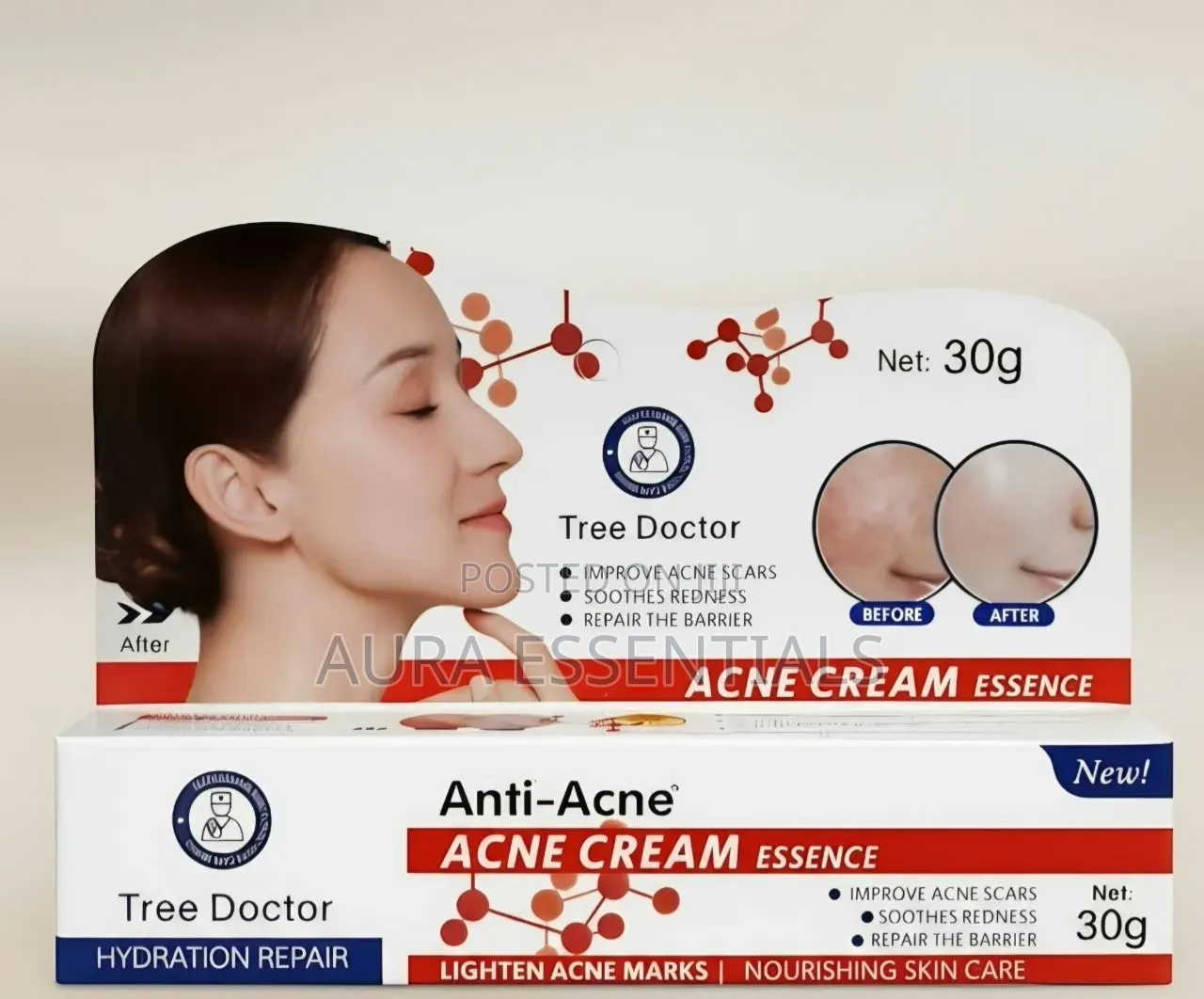 Tree Doctor Anti-Acne Cream Face 30ml