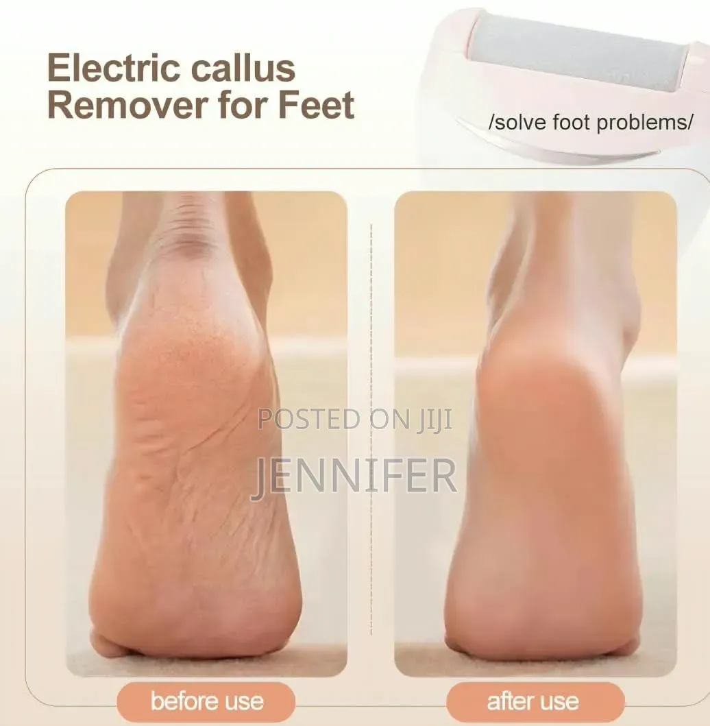 Winning Star Electric Foot Callus Remover (Model ST-5851)