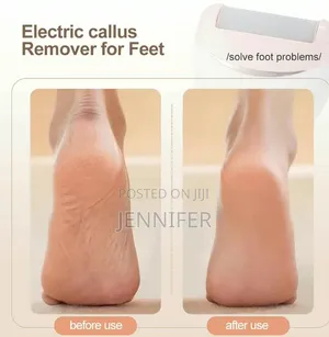 Winning Star Electric Foot Callus Remover (Model ST-5851)