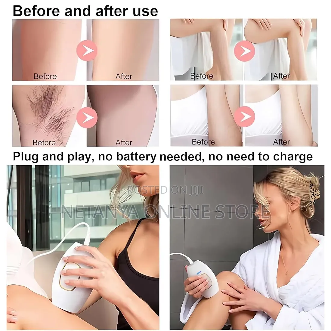 Painless Electric Hair Remover