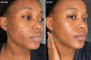 Beauty Formulas 10% Niacinamide Serum