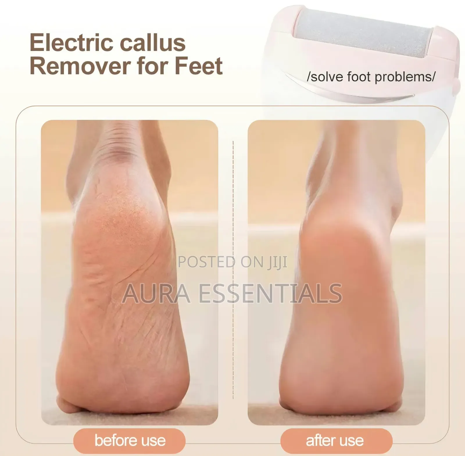 Winning Star Electric Foot Callus Remover (Model ST-5851)