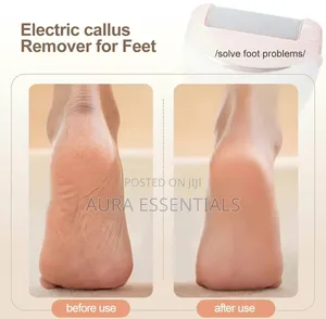 Winning Star Electric Foot Callus Remover (Model ST-5851)