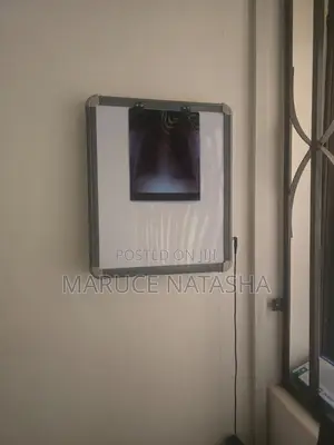 Single X-Ray Illuminator(film Viewer)