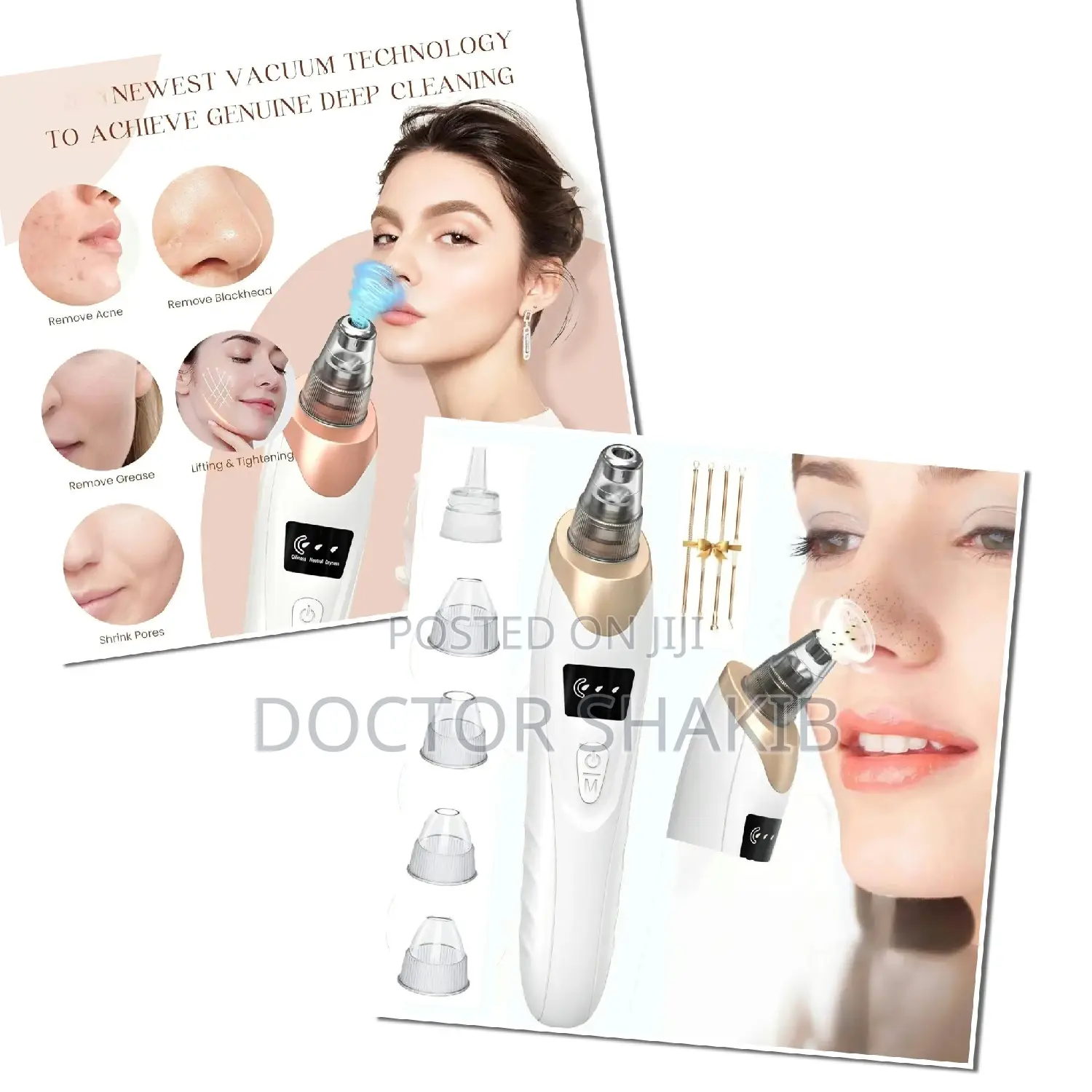 Electric Blackhead Remover Vacuum