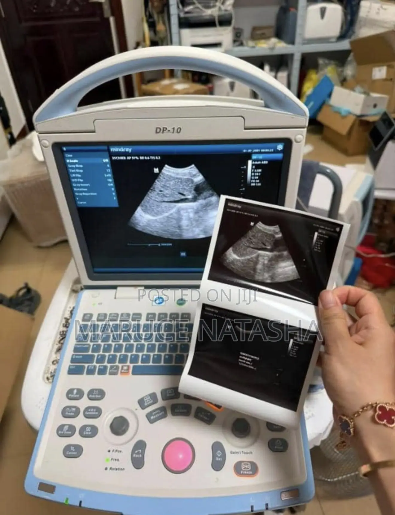 High Quality Lastest Refurbished Mindray Ultrasound Scan Machine