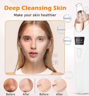 Electric Blackhead Remover Vacuum