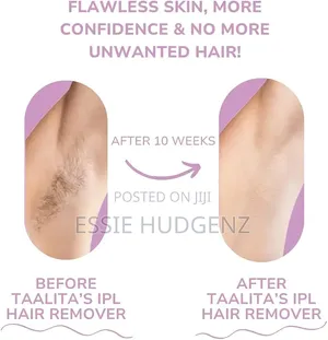 Electric Hair Remover