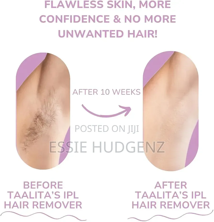 Electric Hair Remover