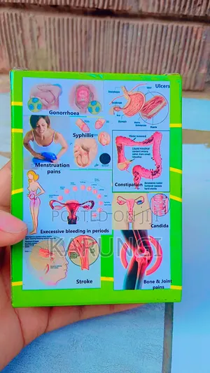 Ryanka 82 for Infections, Ulcers, Candida and Others