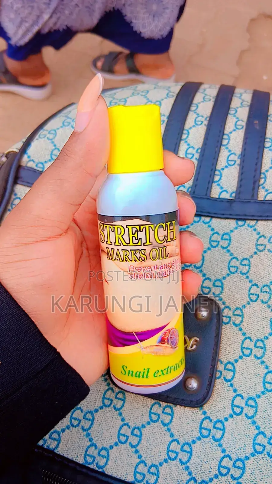 Stretch Marks and Scars Removal Oil