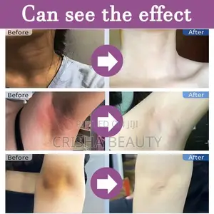 Kojic Under Arm Brightening Serum