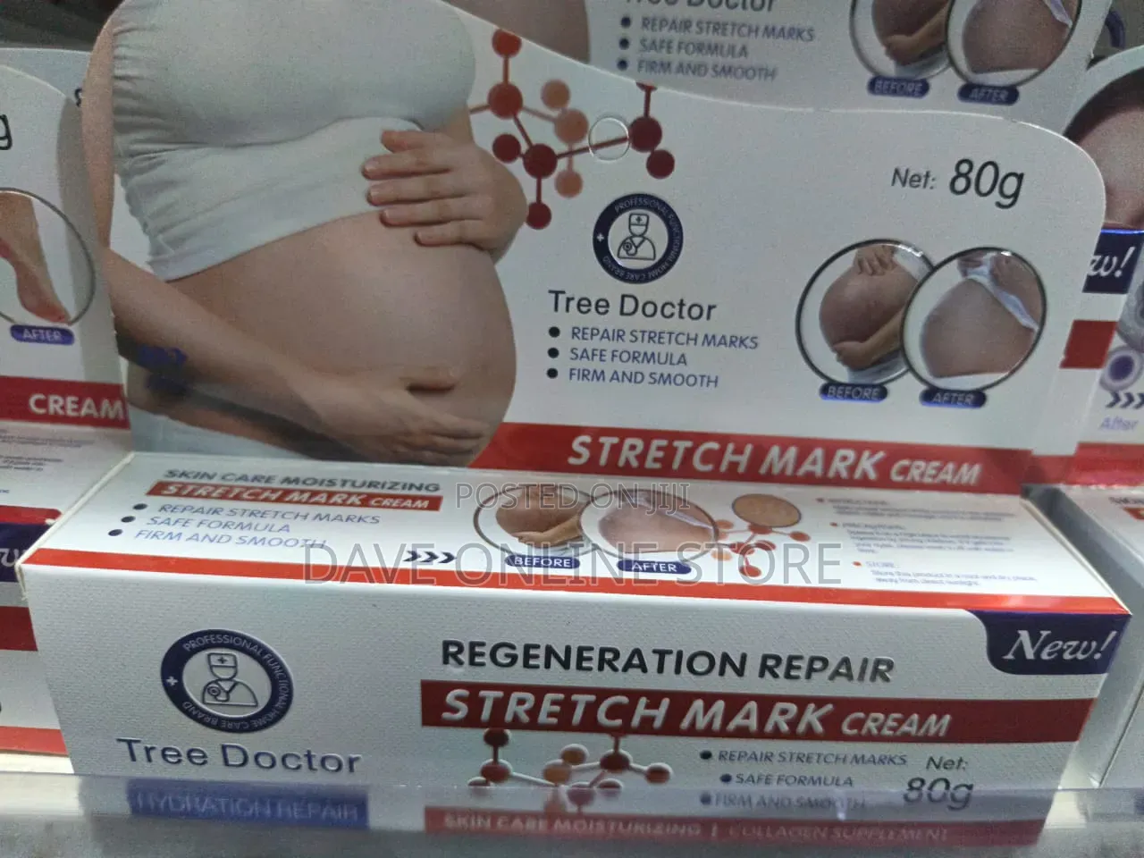 Tree Doctor Regeneration Repair Stretch Mark Cream (80g)