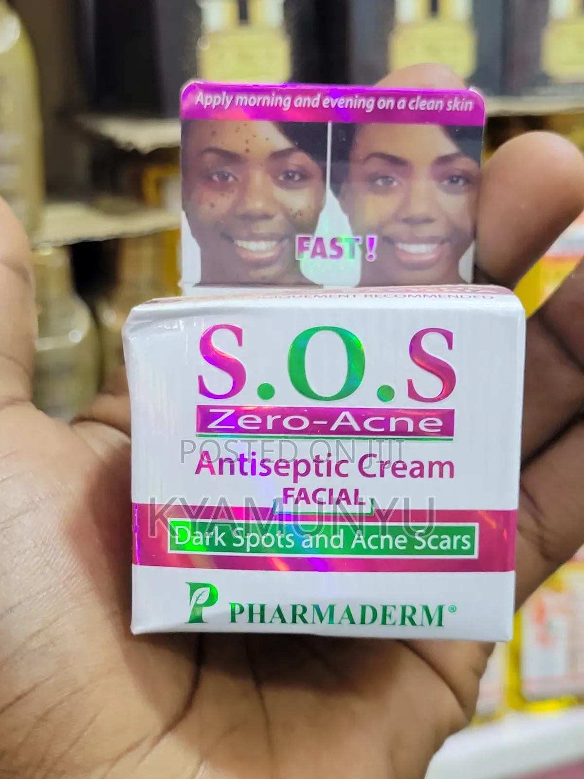 S.O.S Zero Acne Antiseptic Facial Cream.