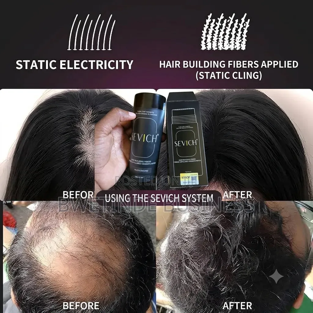SEVICH Hair Building Fibers Black – Instant Hair Thickening Solution