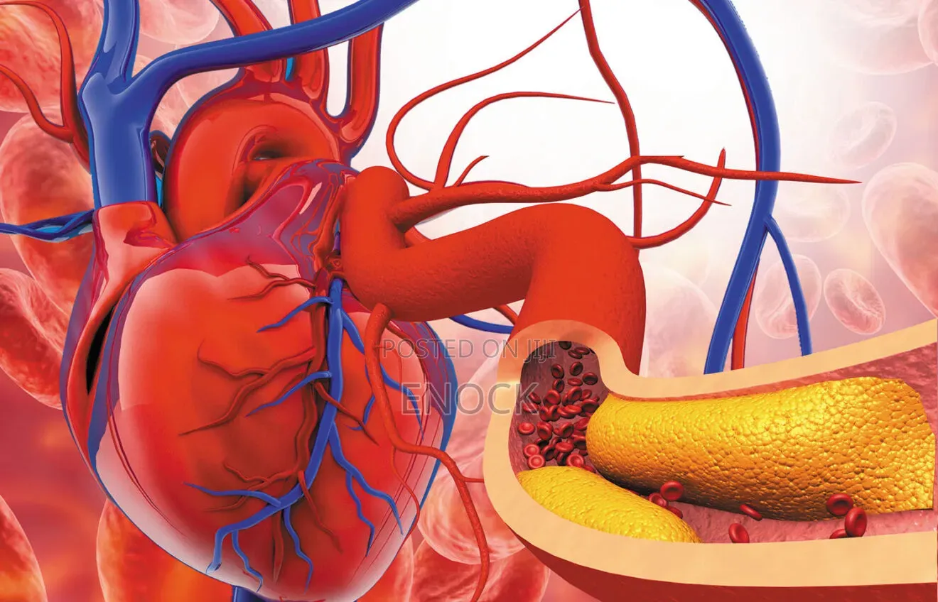 Super Omega-3 (Healthy Heart, Brain Development Etc)