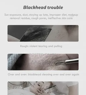 Blackhead Remover Vacuum Face Cleaner Pore Vacuum Suction White Heads