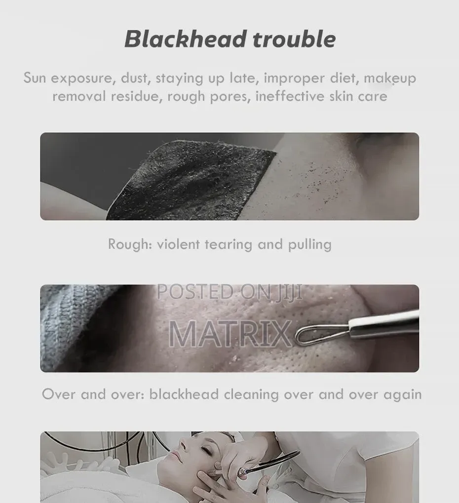 Blackhead Remover Vacuum Face Cleaner Pore Vacuum Suction White Heads