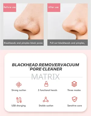 Blackhead Remover Vacuum Face Cleaner Pore Vacuum Suction White Heads