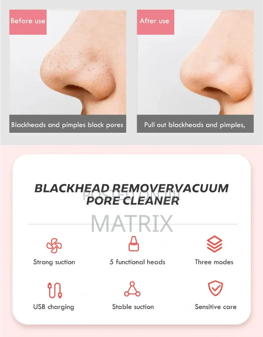 Blackhead Remover Vacuum Face Cleaner Pore Vacuum Suction White Heads