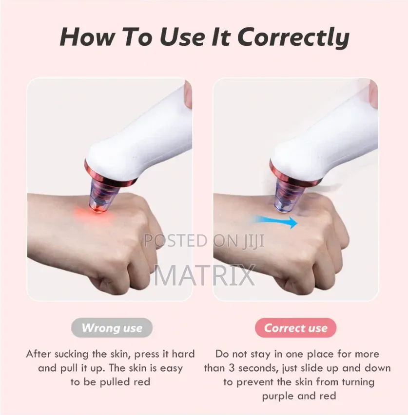 Blackhead Remover Vacuum Face Cleaner Pore Vacuum Suction White Heads