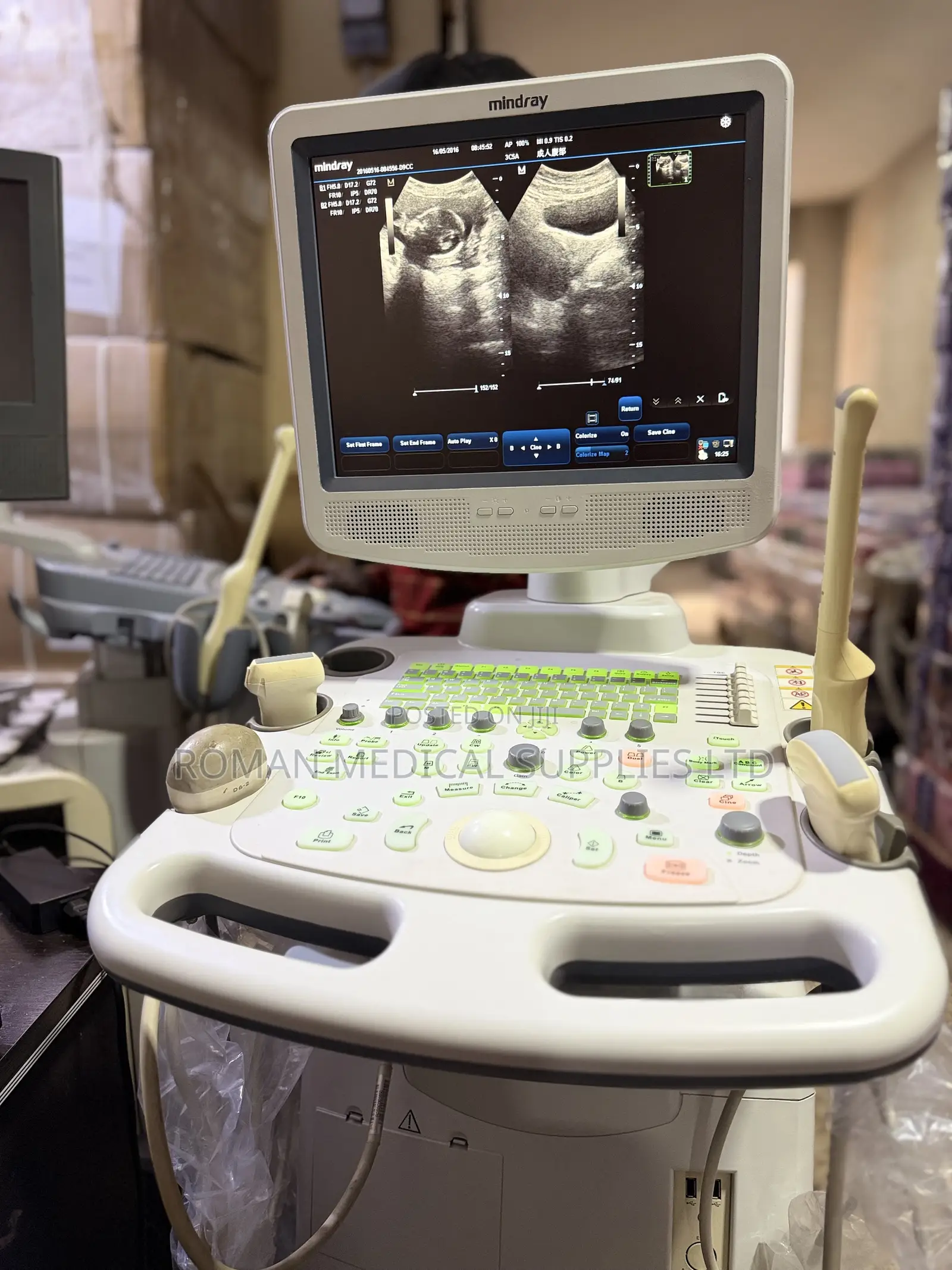 Mindray DC-3 Ultrasound Scan