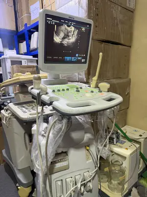 Mindray DC-3 Ultrasound Scan