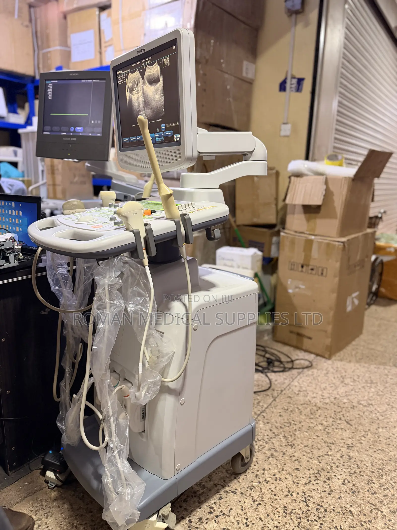 Mindray DC-3 Ultrasound Scan