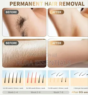 IPL Hair Removal Device for Women Men