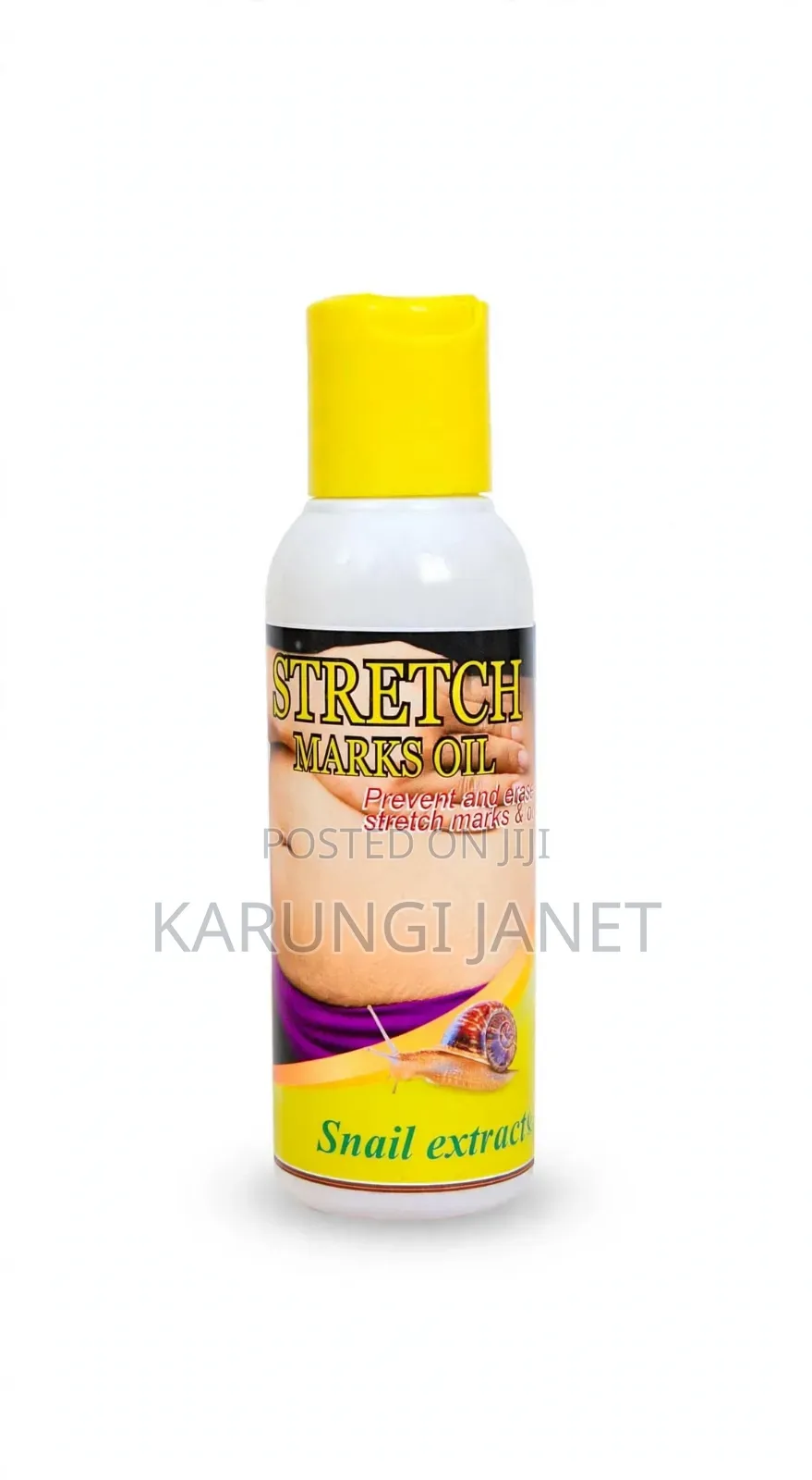 Stretch Marks and Scars Removal Oil